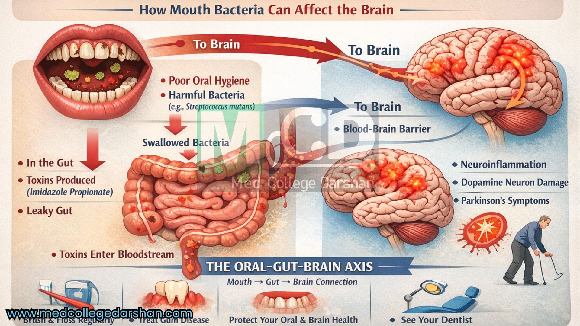 Bad Oral Bacteria May Travel to the Brain and Trigger Parkinson’s Disease